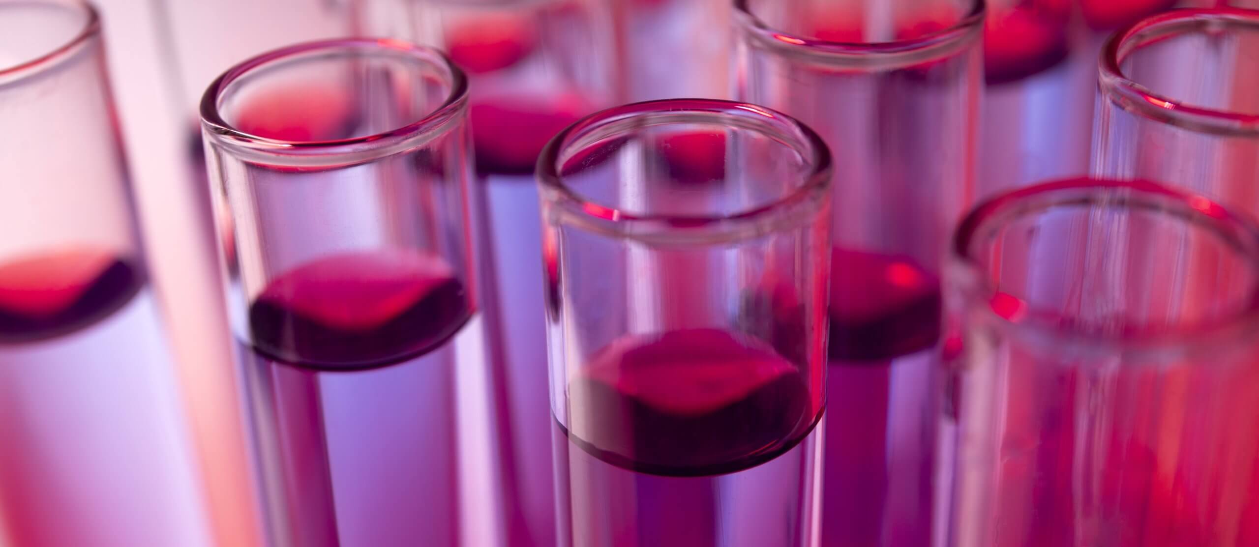 horizontal-science-banner-with-glass-containers Chemikalien entsorgen